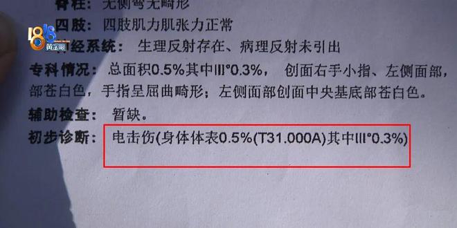 BB电子糖果派网站后怕！5岁男童瞬间晕厥筋都断了……街上常见看见立即远离(图8)